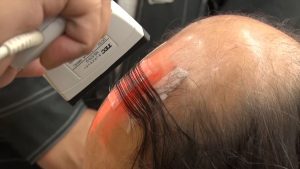 『X秒後の新世界』